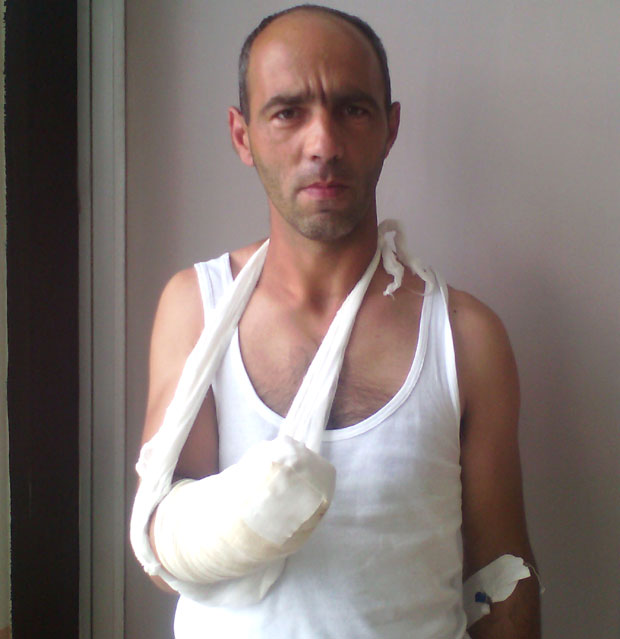 Радник коме је млин самлео шаку: Ја сам крив за несрећу!